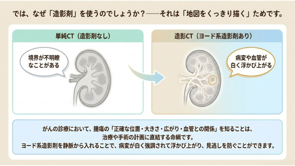 なぜ造影剤をつかうのか